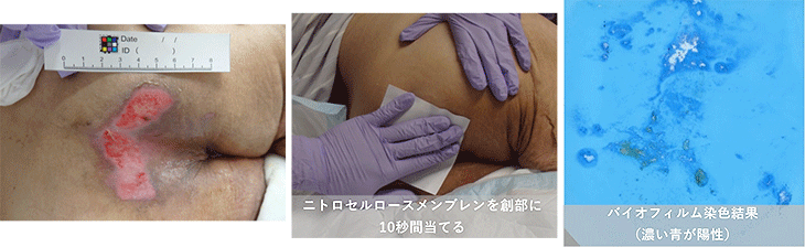ウンドブロッティングによるバイオフィルム検出